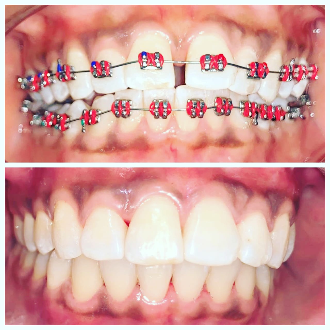 Some questions about nutrition & oral health?